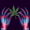 Cannabis Relieves Arthritis: Learn How to Use It to Repair Arthritic Joints