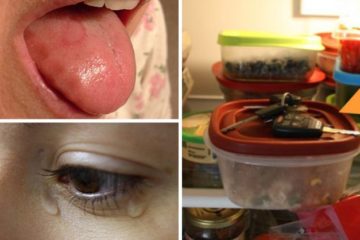 Vitamin B12 Deficiency Symptoms that most People Ignore