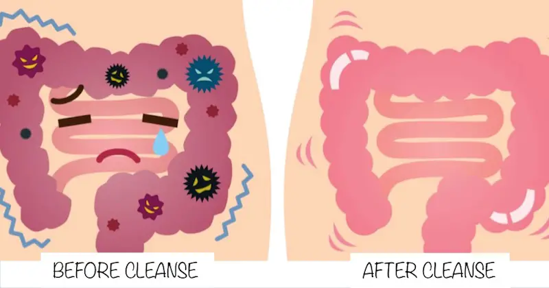 Colon Cleansing: Complete Guide to Flush Out Pounds of Fecal Waste