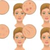 6 Foods You Had No Idea Were Destroying Your Hormones and Your Skin