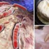 Oncologists Urge You to Stop Eating these 8 Foods that Are Proven to Cause Cancer
