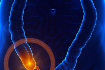 6 Signs Your Appendix Is about to Burst