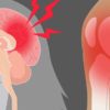 Magnesium Deficiency Is Killing Us. Here Is what to Do about It
