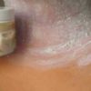 Remove those Annoying Dark Patches on the Neck, Underarms & Inner Thighs in 15 Minutes