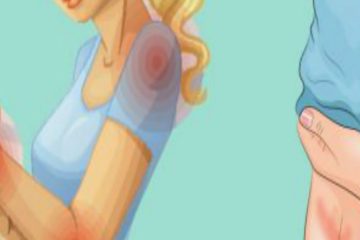 10 Signs Your Gut Is Overloaded with Toxins
