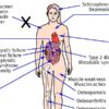 10 Common Diseases Associated with Vitamin D Deficiency