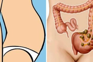 How to Get Rid of Bloating: 9 Strategies Backed by Science