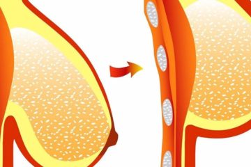 2 Great Tips for Naturally Perky Breasts