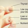 10 Nail Symptoms & what They Mean for Your Health