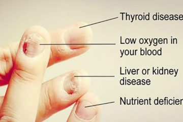 10 Nail Symptoms & what They Mean for Your Health