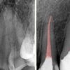 This Dentist Refused to Perform a Root Canal for over 20 Years- This Is Why