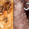 This Is the Dirties Body Part! Here Is How to Clean it from Germs & Bacteria to Prevent Diseases