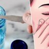 New Sinus Infection Treatment Will Replace Antibiotics