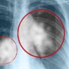 10 Hidden Things that Increase Your Cancer Risk