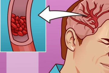 22 Problems Caused by Magnesium Deficiency And The Warning Signs