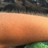 If You Get Chills when Listening to Music, You May Have a Unique Brain
