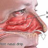 How to Clear Your Sinuses in Seconds Using only Your Fingers