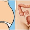 You Are not Fat- You Are Bloated! Here Is How to Treat this Problem