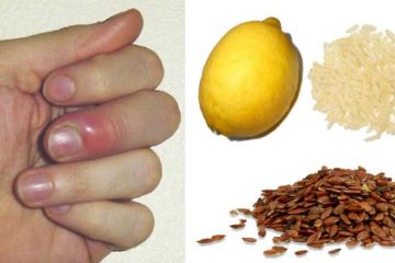 5 Effective & Easy Ways to Treat Finger & Toe Whitlow