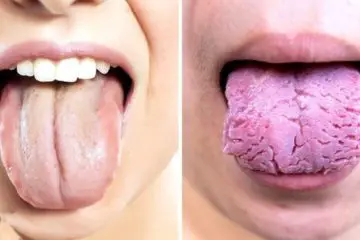 Your Tongue Is Trying to Reveal these 3 Things about Your Health: Pay Attention