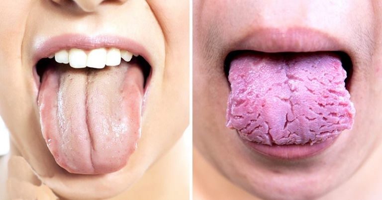 Your Tongue Is Trying To Reveal These 3 Things About Your Health Pay