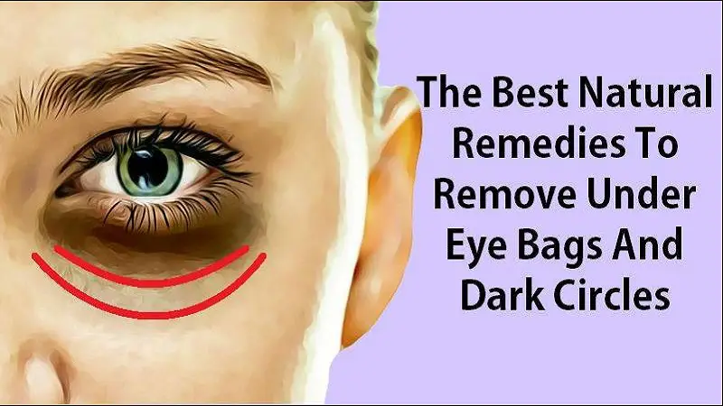 download dark under eye treatment