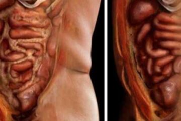 Just Use 2 Ingredients To Empty All The Deposits Of Fats And Parasites Of The Body!