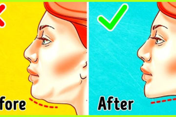 How to Get Rid of Double Chin: 5 Amazing Remedies