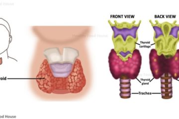 12 Million Women Ignore Thyroid Disorder Symptoms. Why You Need to Know the Indicating Signs?