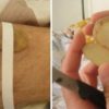 7 “Bizarre” Home Remedies Our Grandparents Used & Work Optimally