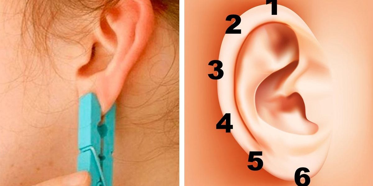 Amazing Leave a Clothespin on Your Ear for 20The Results Will