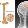 This Common Beverage Destroys the Bones & Is Full of Cancerous Chemicals