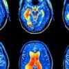 Complaining Is not Good for You: It Physically Rewires the Brain to Be Depressed & Anxious