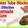 Natural Treatment for Blocked Fallopian Tubes
