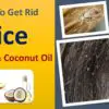 Your Child Has Lice? Use this all-Natural Potent Remedy to Destroy them fast