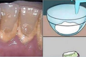 DIY Mouthwash: Remove All Plaque from Teeth in 2 Minutes