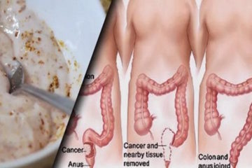 Remove Pounds of Toxins from the Intestines with these 2 Ingredients