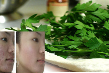 Use this Plant’s Leaves & Relieve Acne, Wrinkles, Sun Allergies & Dark Spots