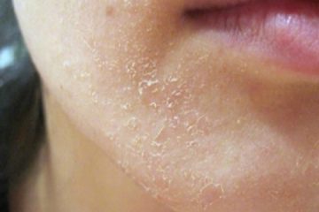 Your Body Is Seeking Help: 10 Crucial Symptoms You Must not Ignore