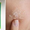 8 Common Health Issues You can Treat with 2 tbsp of Epsom Salt
