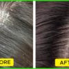 The Different Types of Dandruff & How to Treat Them