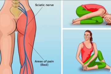 6 Simple Yoga Poses For Sciatica Pain Relief