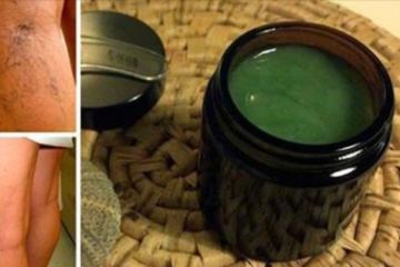 DIY Garlic & Lemon Ointment to Relieve Varicose Veins