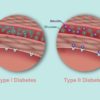 Be Prepared: The Symptoms of Diabetes & Who Is at Risk