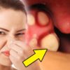 5 DIY Remedies to Fight Off Bad Breath Naturally