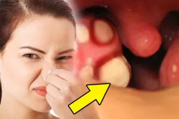 5 DIY Remedies to Fight Off Bad Breath Naturally
