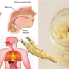 Make this Horseradish Remedy & Remove Phlegm & Mucus from the Lungs