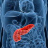 Pancreatic Cancer: Never Ignore these 6 Warning Symptoms
