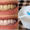 This Is How You Can Use Baking Soda & Clean Your Face & Hair & Whiten the Teeth