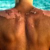 It Is Sunscreen that Is Causing Skin Cancer, not the Sun- This Is How